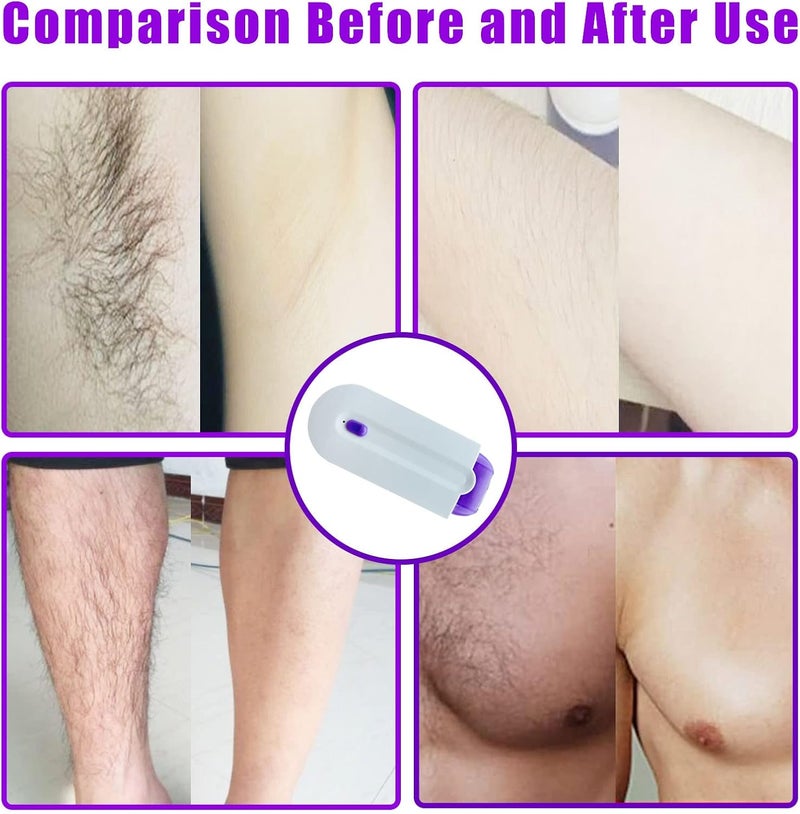 GNDROO Valentines Day Gifts for Her Focusing Silky Smooth Hair Eraser, Portable Painless Hair Removal Tool, Rechargeable Epilator Smooth Touch Hair Remover, Applicable to Any Part of The Body Gift for Women - Image 1